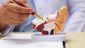 Understanding Sensorineural Hearing Loss A Comprehensive Guide